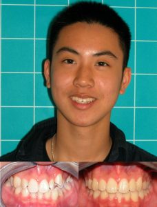 Orthodontics