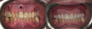 8-intra-oral-before-and-after