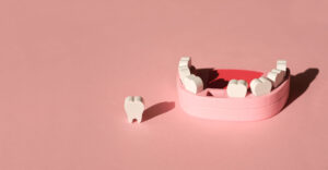 Dental pink jaw model showing a missing tooth space
