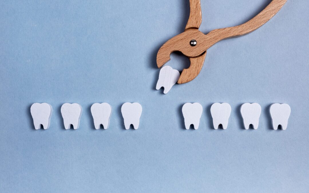 Beyond Aesthetics: Why Replacing a Missing Tooth Matters