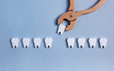 Beyond Aesthetics: Why Replacing a Missing Tooth Matters